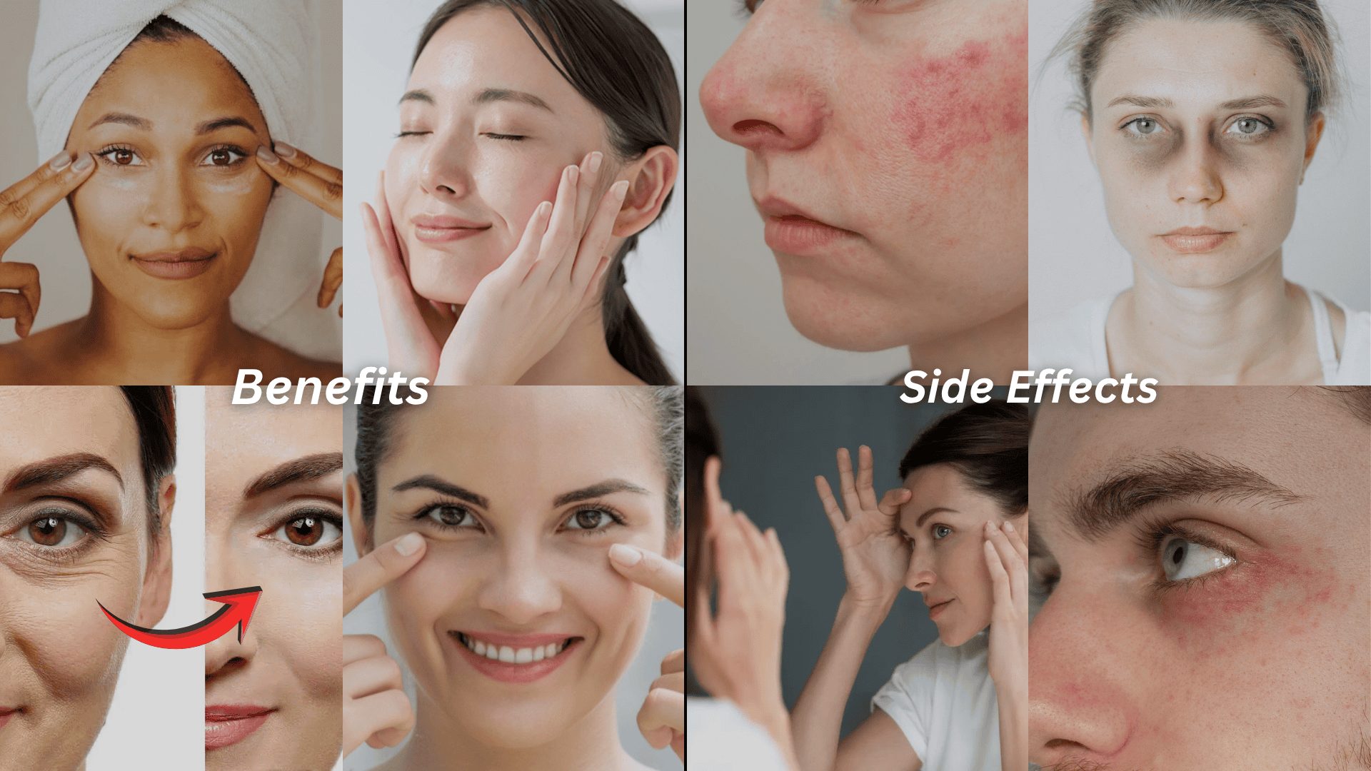 Benefits and Side Effects of prp under eyes treatment