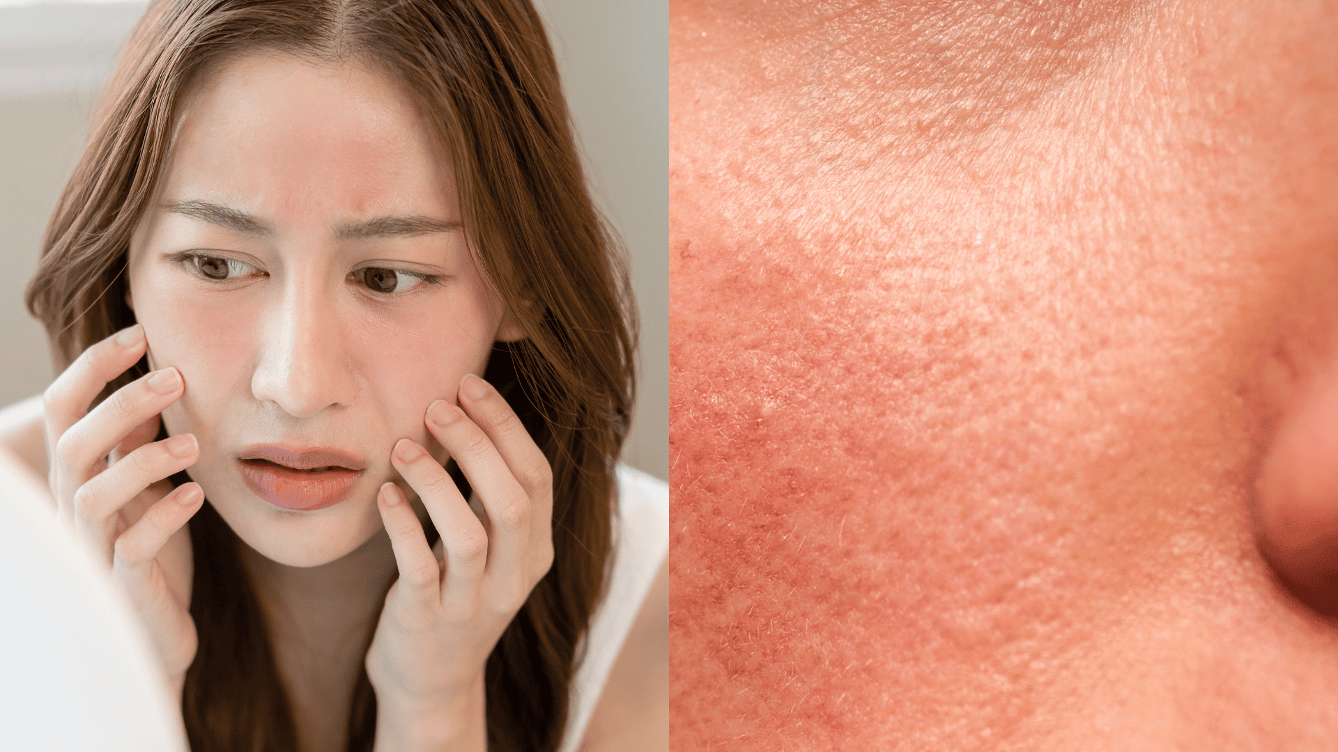 signs of retinol purge mild sensitivity to touch