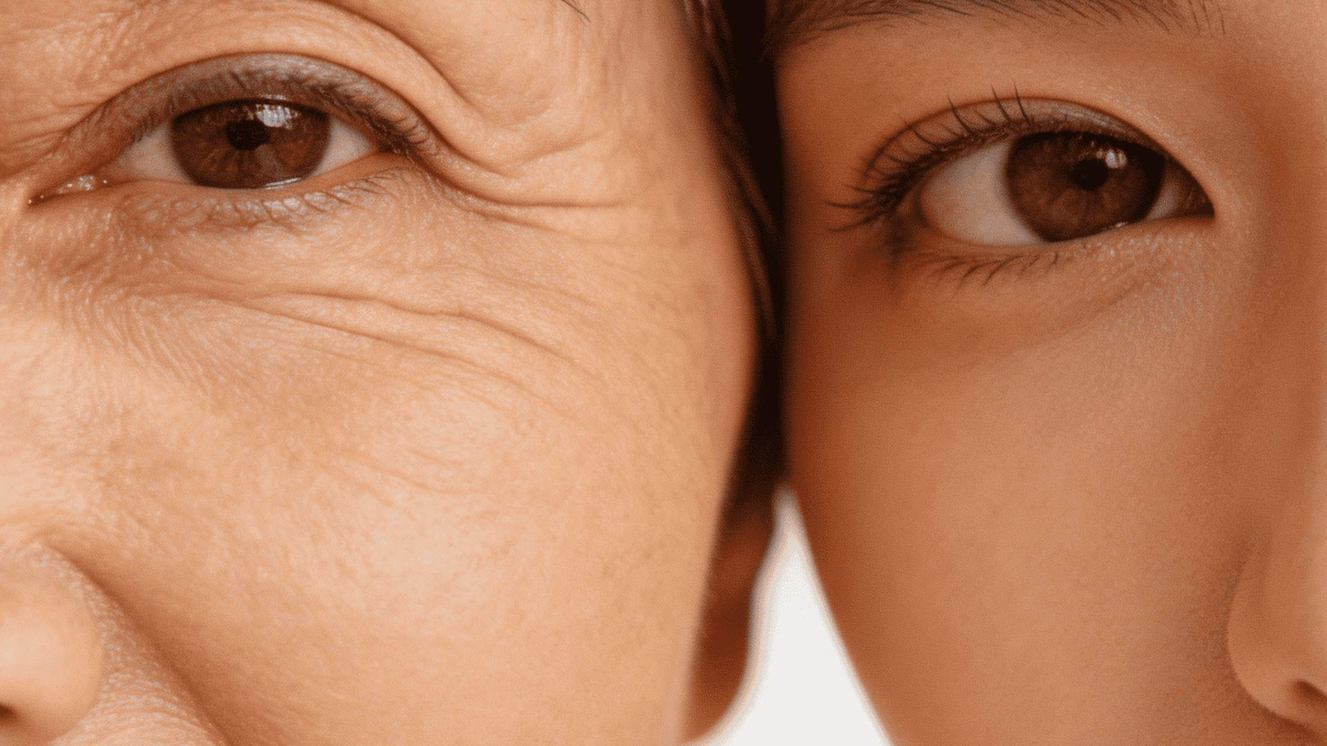 Close-up comparison of two eyes showing wrinkled skin on one side and smooth, youthful skin on the other