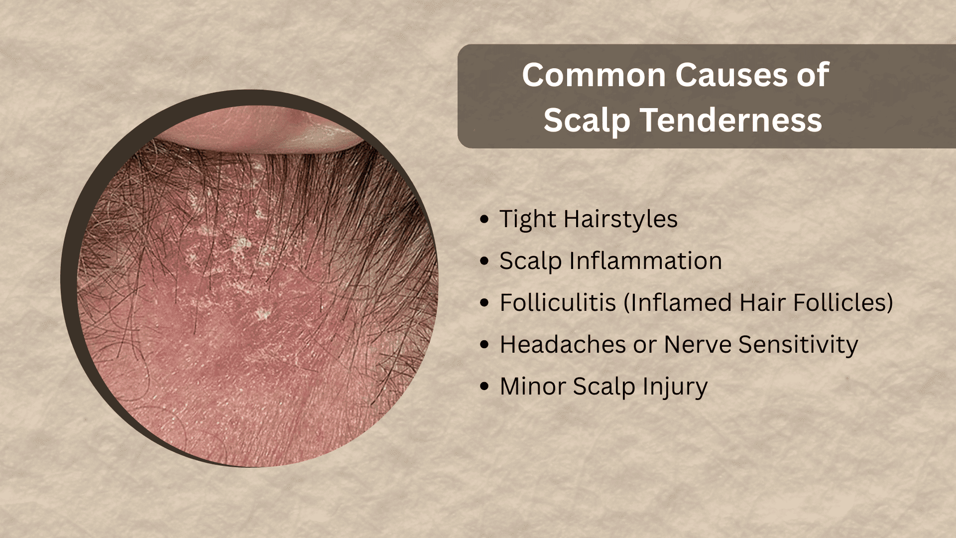 Infographic showing common causes of scalp tenderness with a close-up image of an inflamed scalp and a list of possible causes