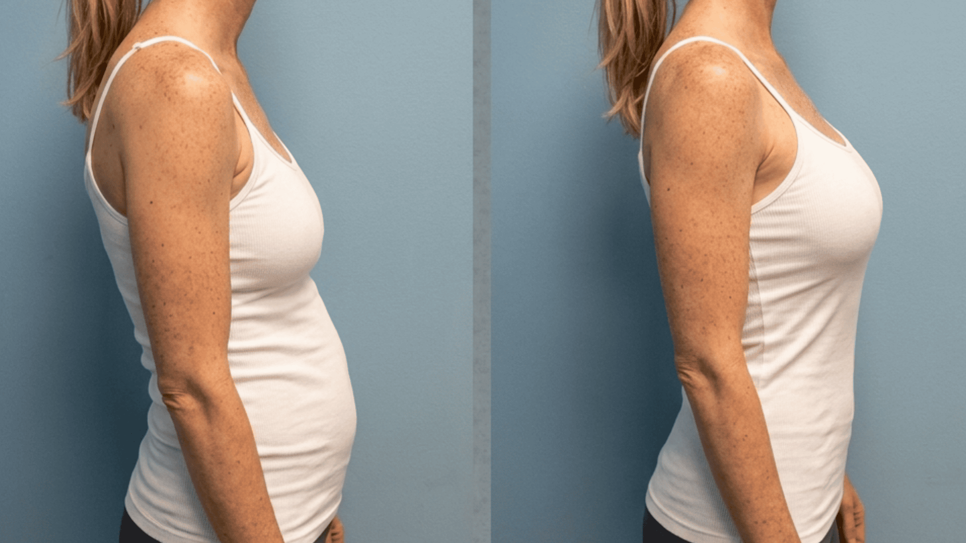 Side-by-side image showing a womanโs side profile before and after posture improvement, with the second image showing a straighter back and more upright posture