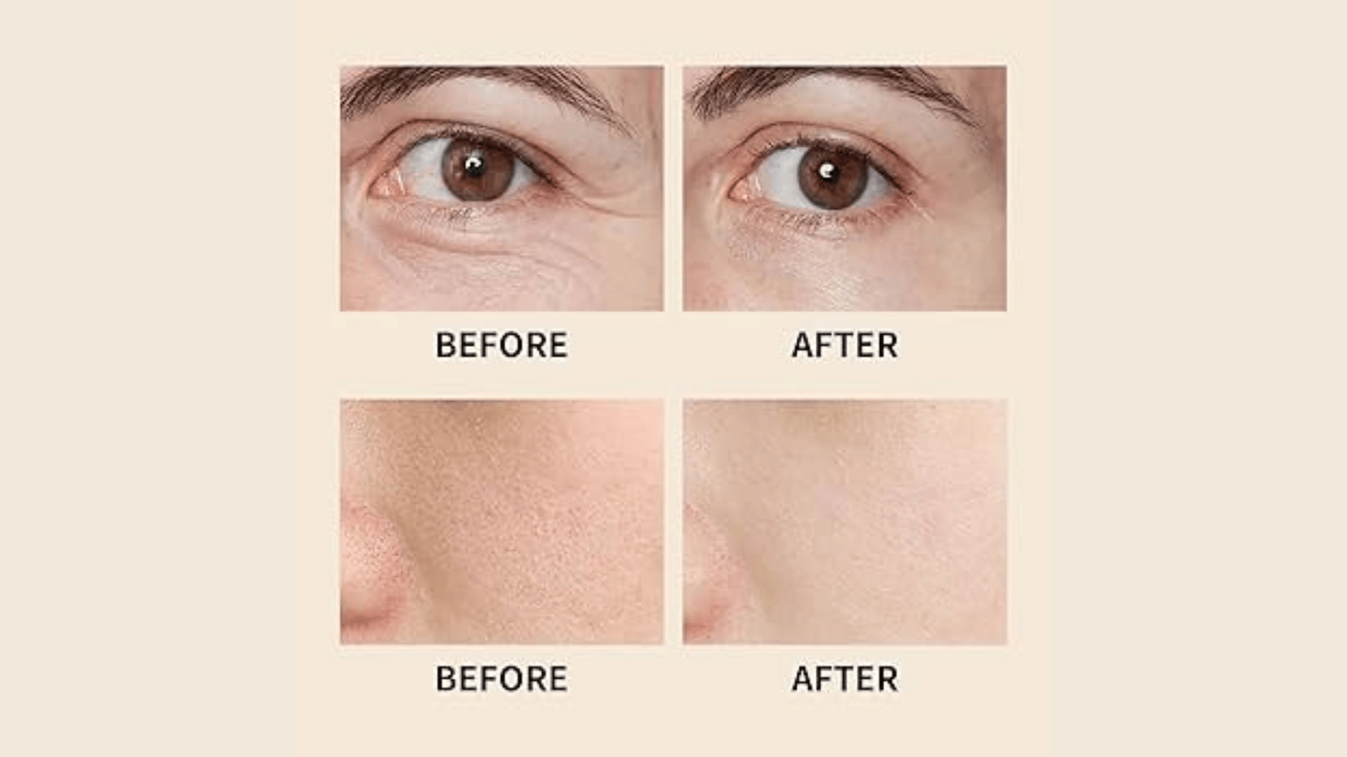 Before and after comparison of skin showing reduced fine lines around the eye and smoother skin texture