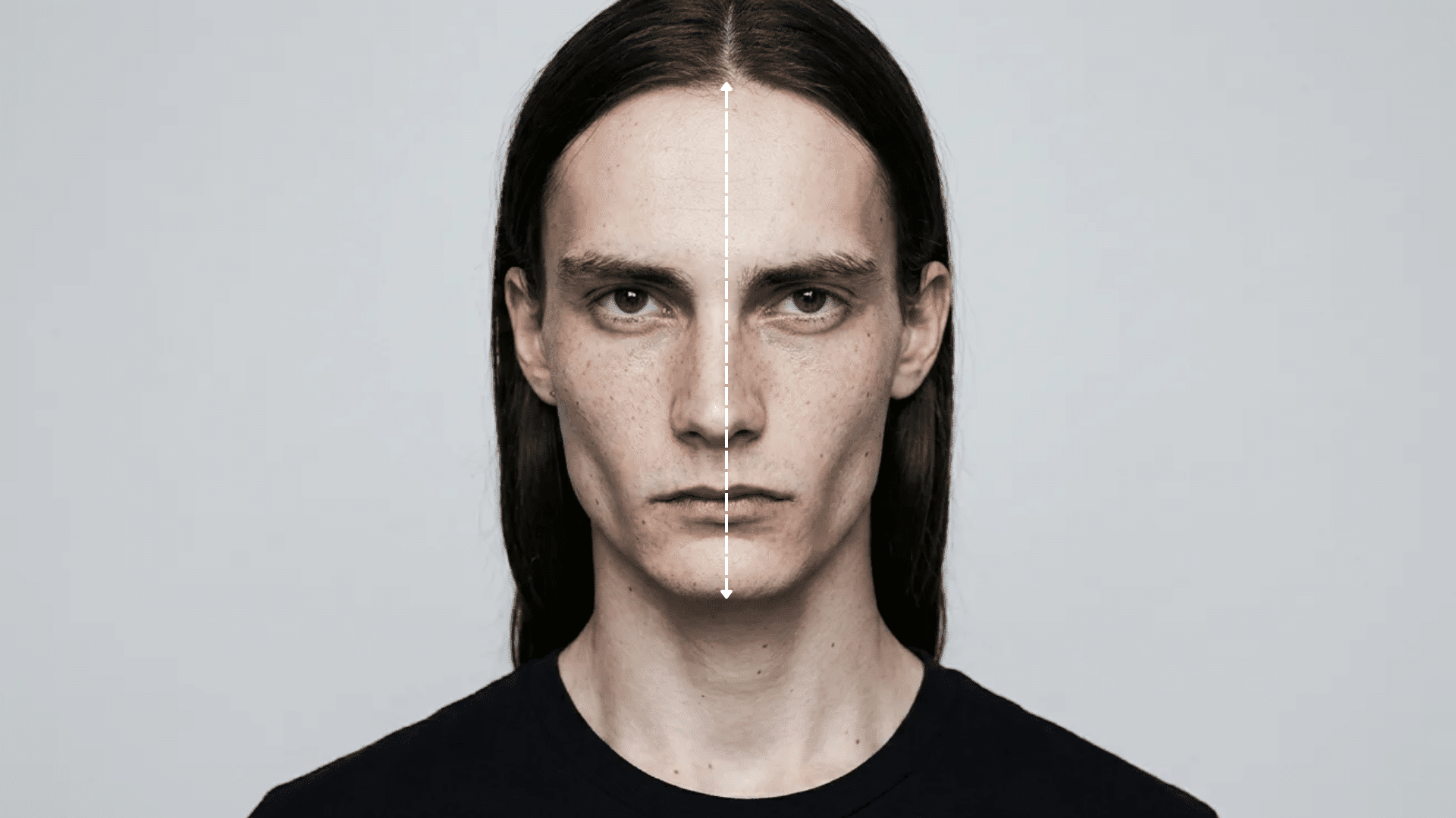 Close-up of a person with a long face, with a vertical line marking facial length from forehead to chin, highlighting elongated proportions.