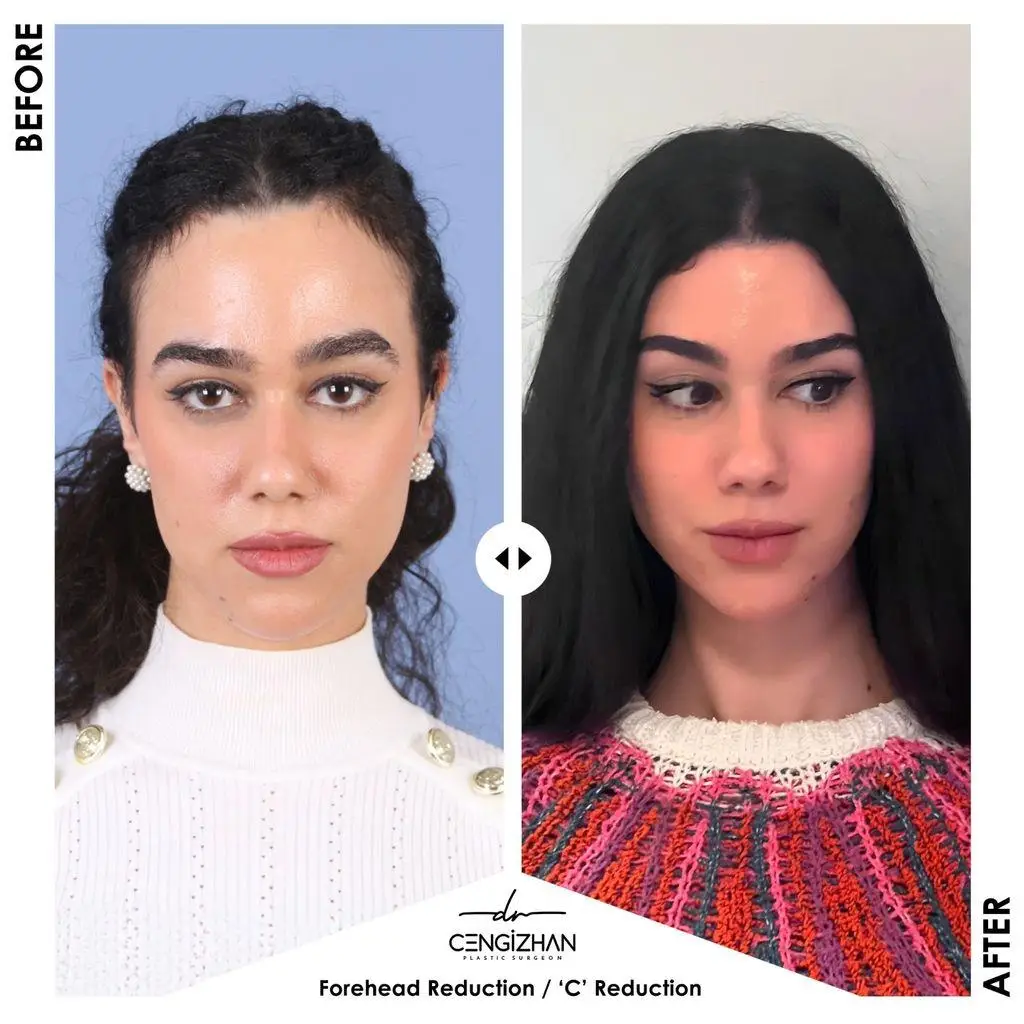 Before and after images showing two women with different hairstyles and facial expressions