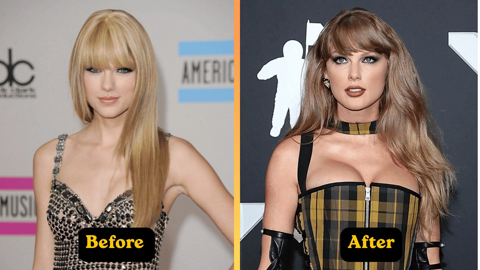Taylor Swift plastic surgery before and after comparison showing changes in body appearance.