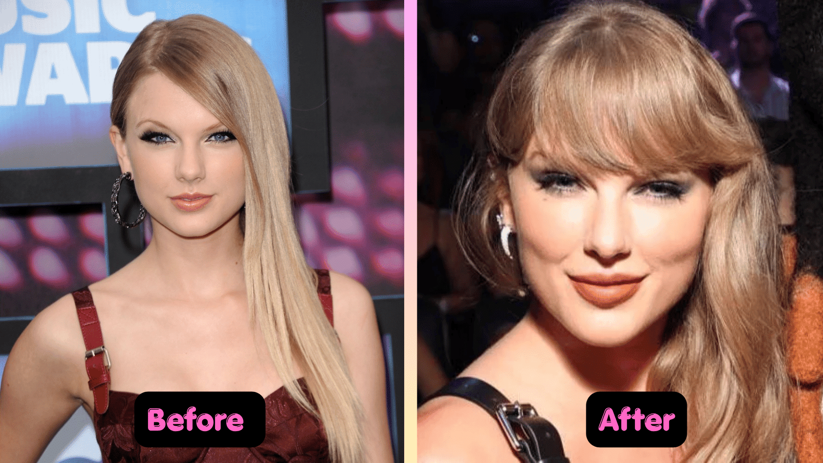 Taylor Swift plastic surgery before and after comparison showing changes in cheek appearance.