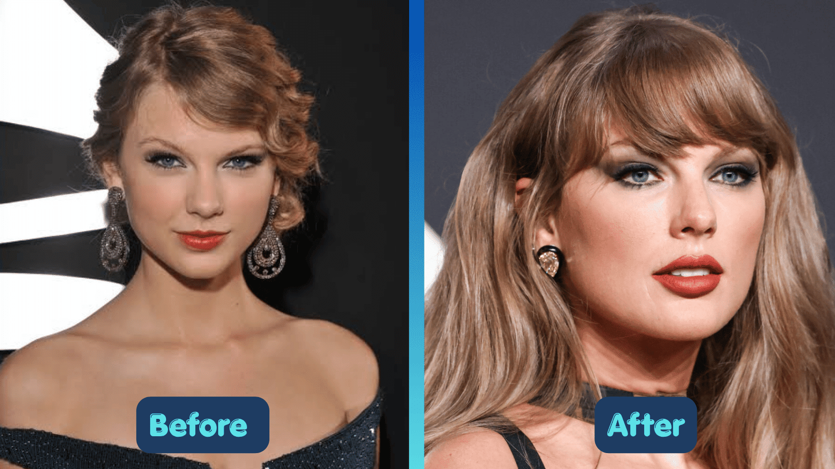 Taylor Swift plastic surgery before and after comparison showing changes in lips and facial appearance.