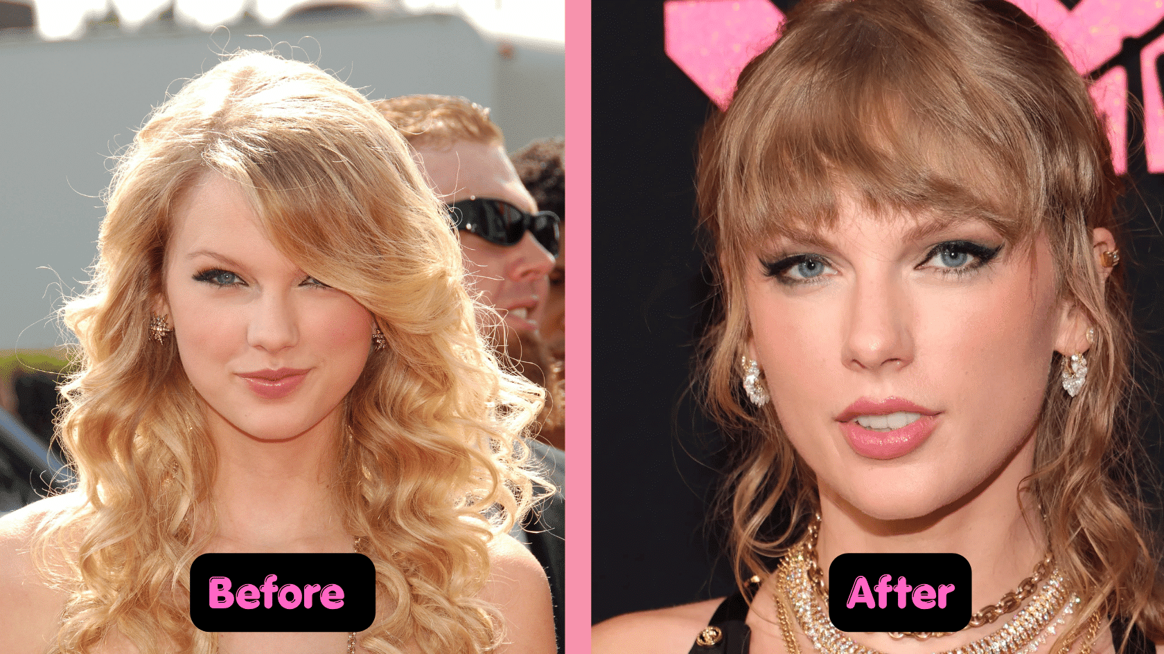 Taylor Swift plastic surgery before and after comparison showing changes in facial appearance over time.