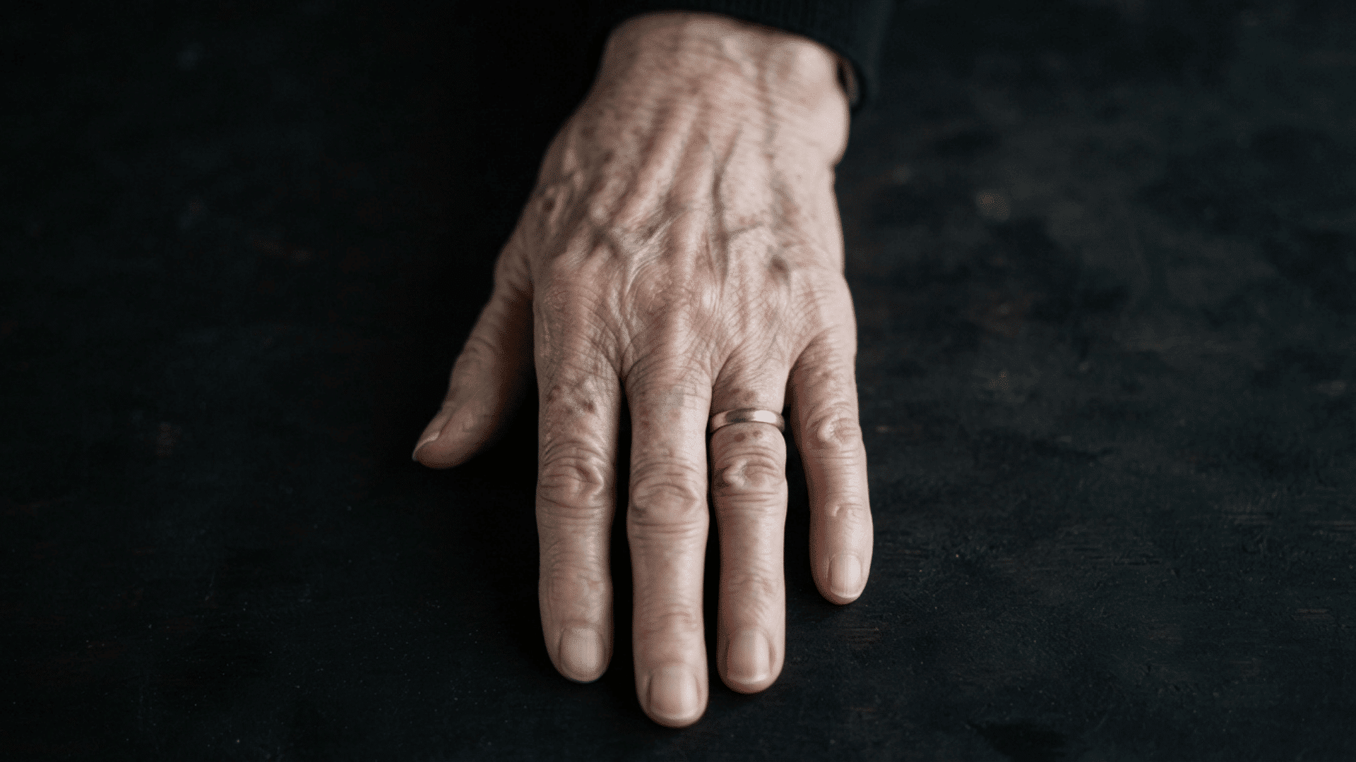 Elderly hand wearing a wedding ring resting on a dark surface.