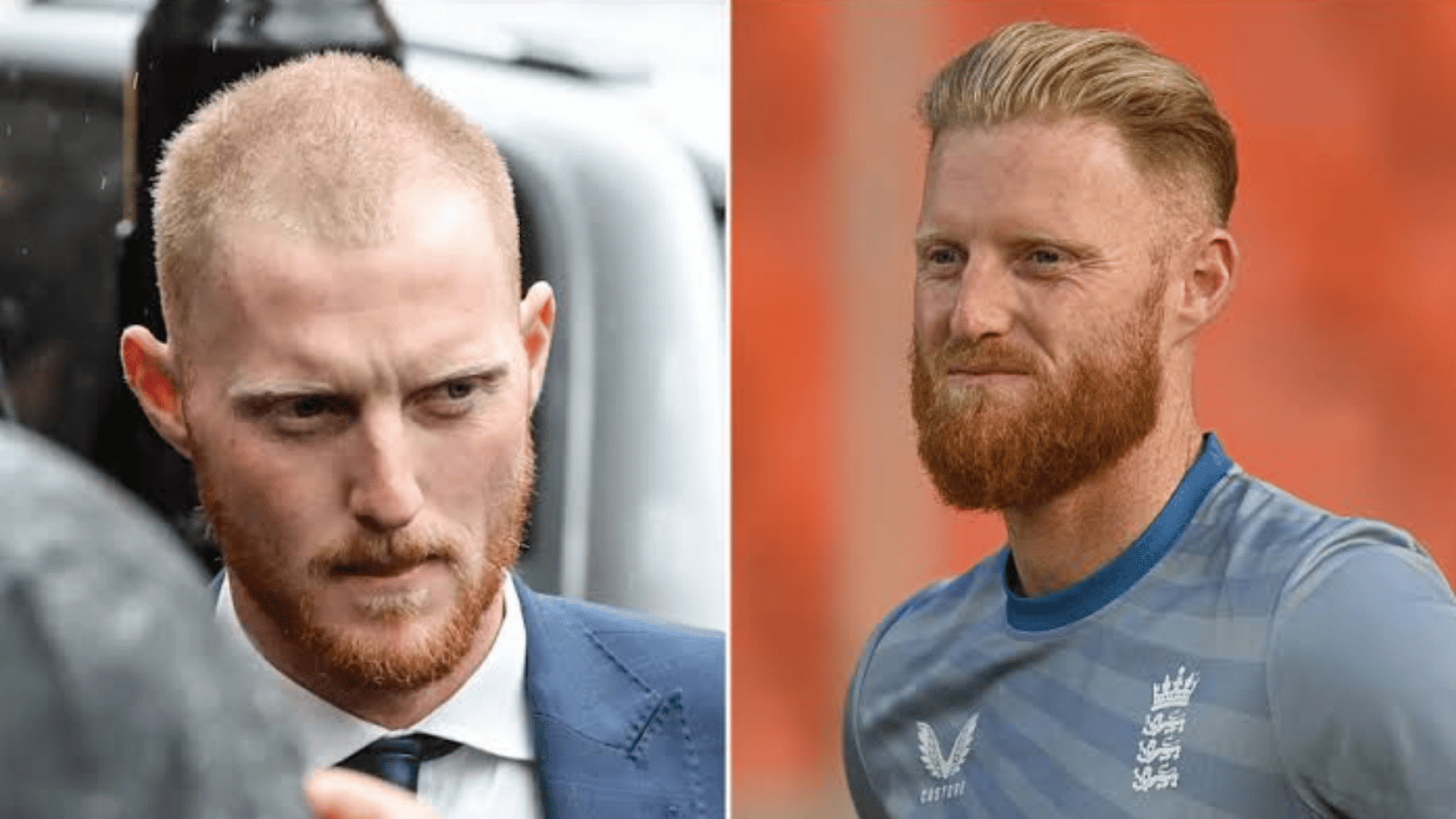 Side-by-side comparison of Ben Stokes before and after a hair transplant procedure.