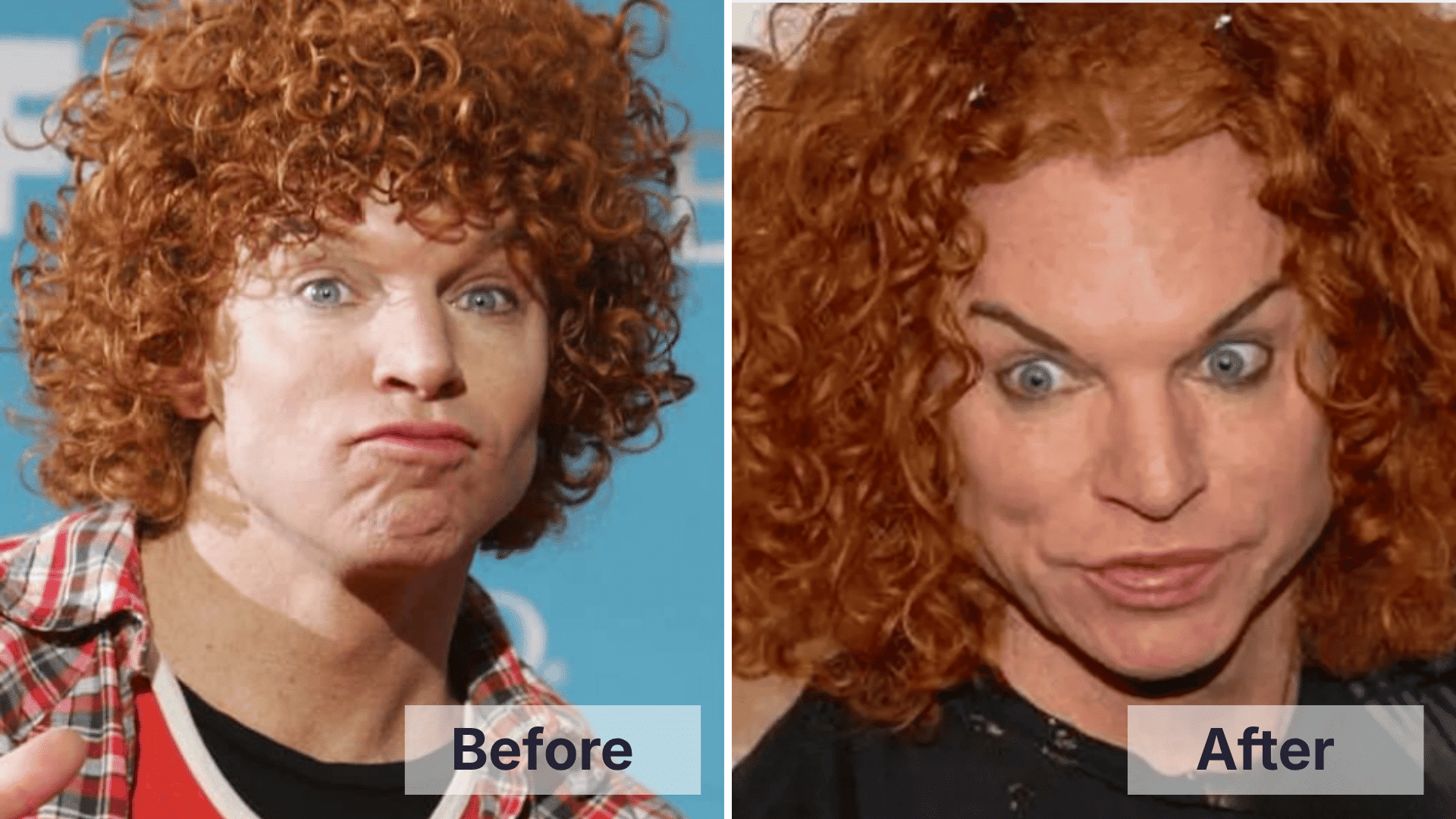 Carrot Top before and after facial changes shown in a split image for worst celebrity plastic surgery examples.