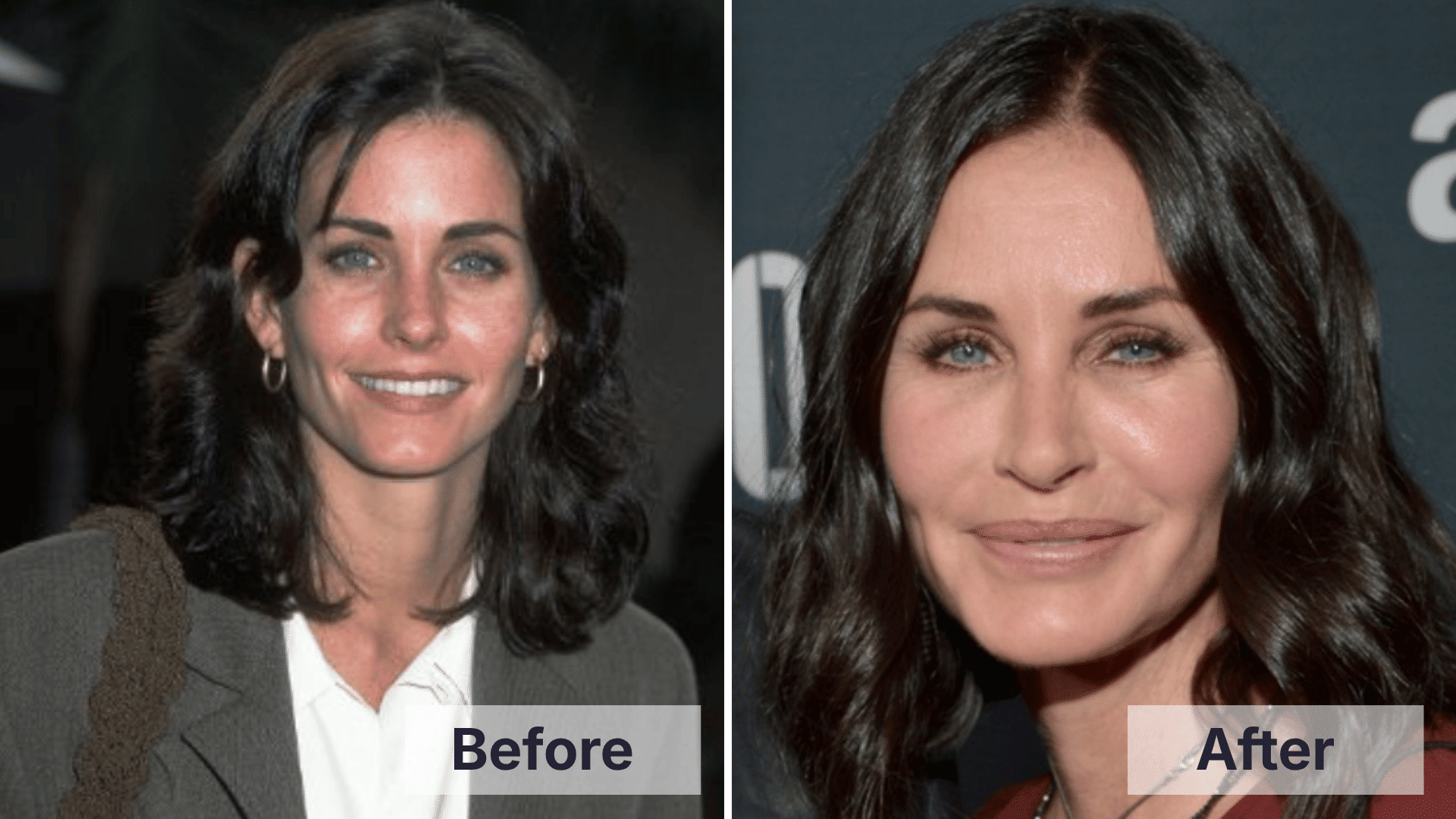 Courteney Cox before and after facial changes shown in a split image for worst celebrity plastic surgery examples.