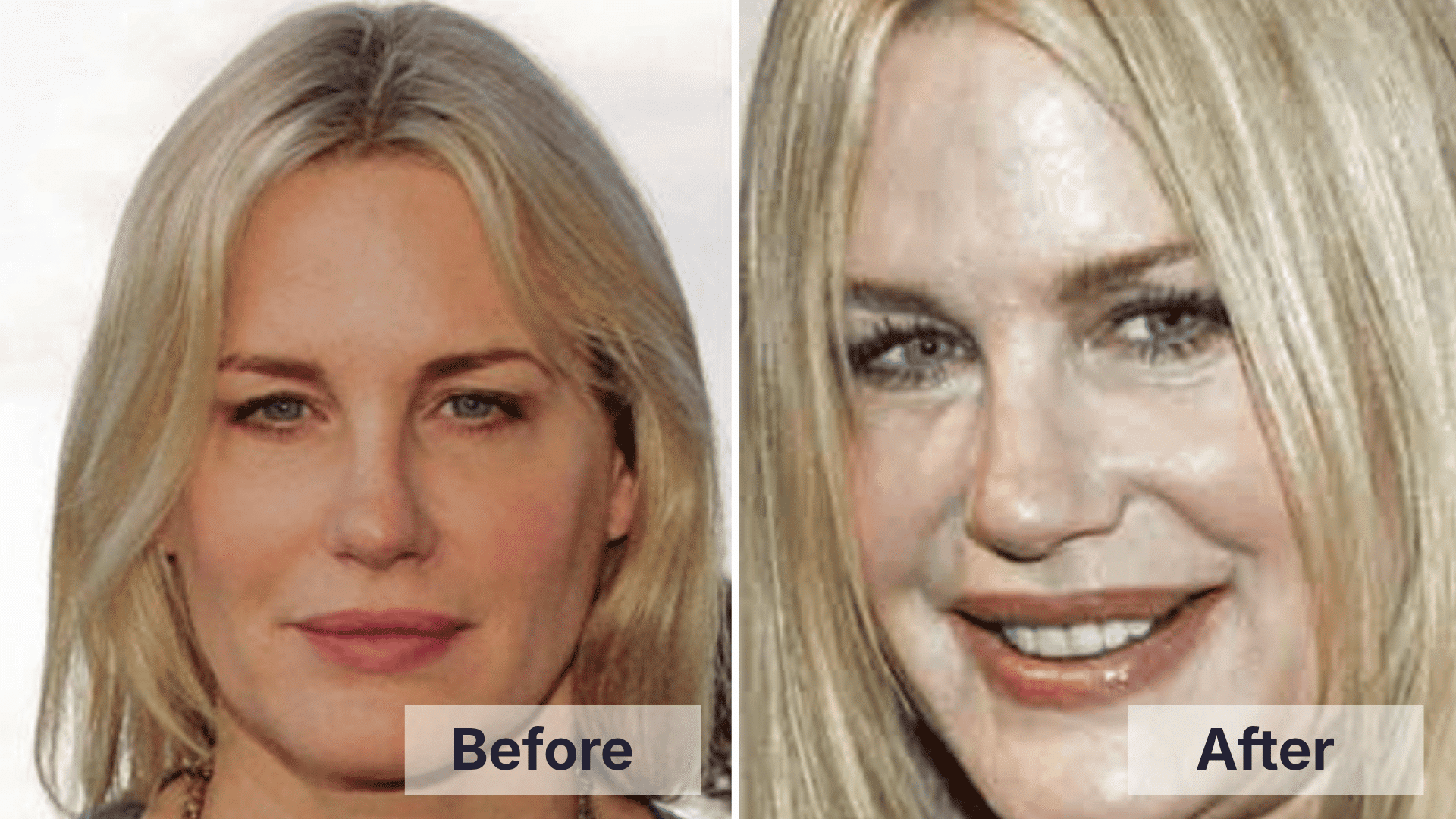 Daryl Hannah before and after comparison showing changes discussed in worst celebrity plastic surgery examples.