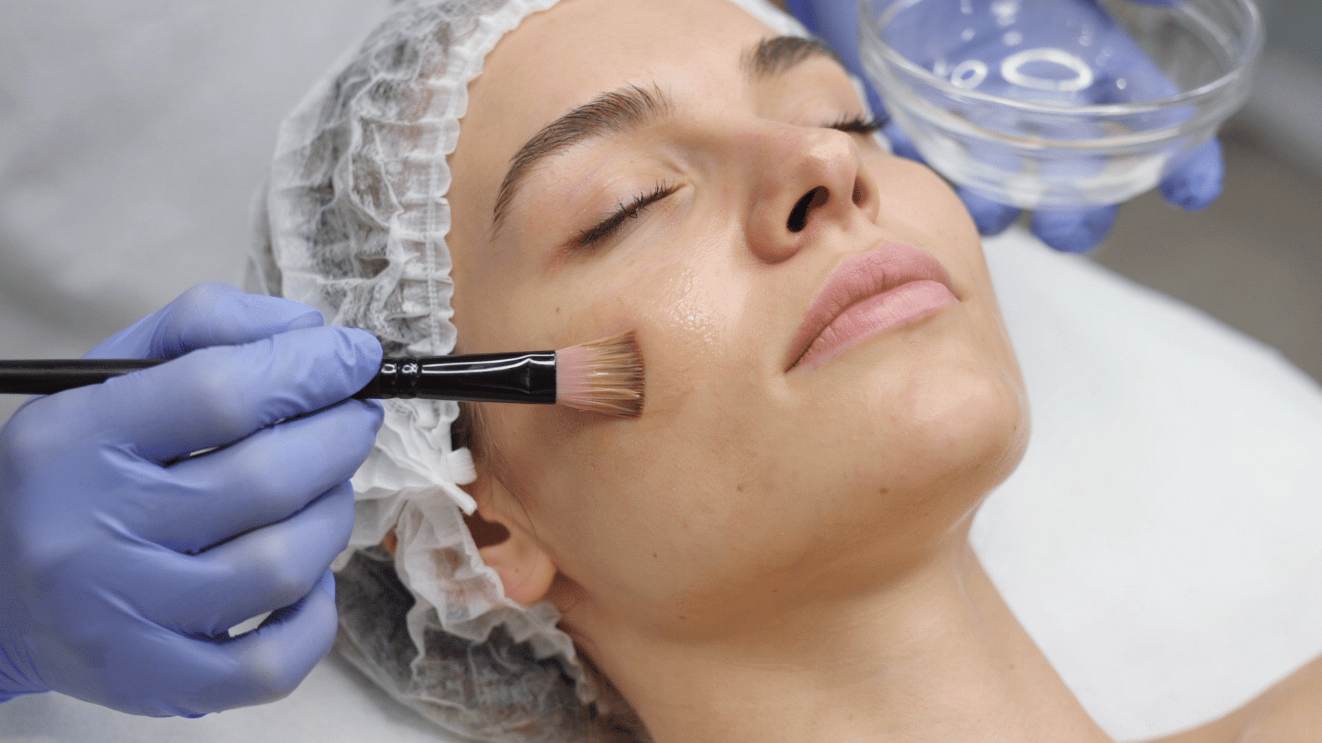 Esthetician applies a chemical peel solution to a cheek using a cosmetic brush
