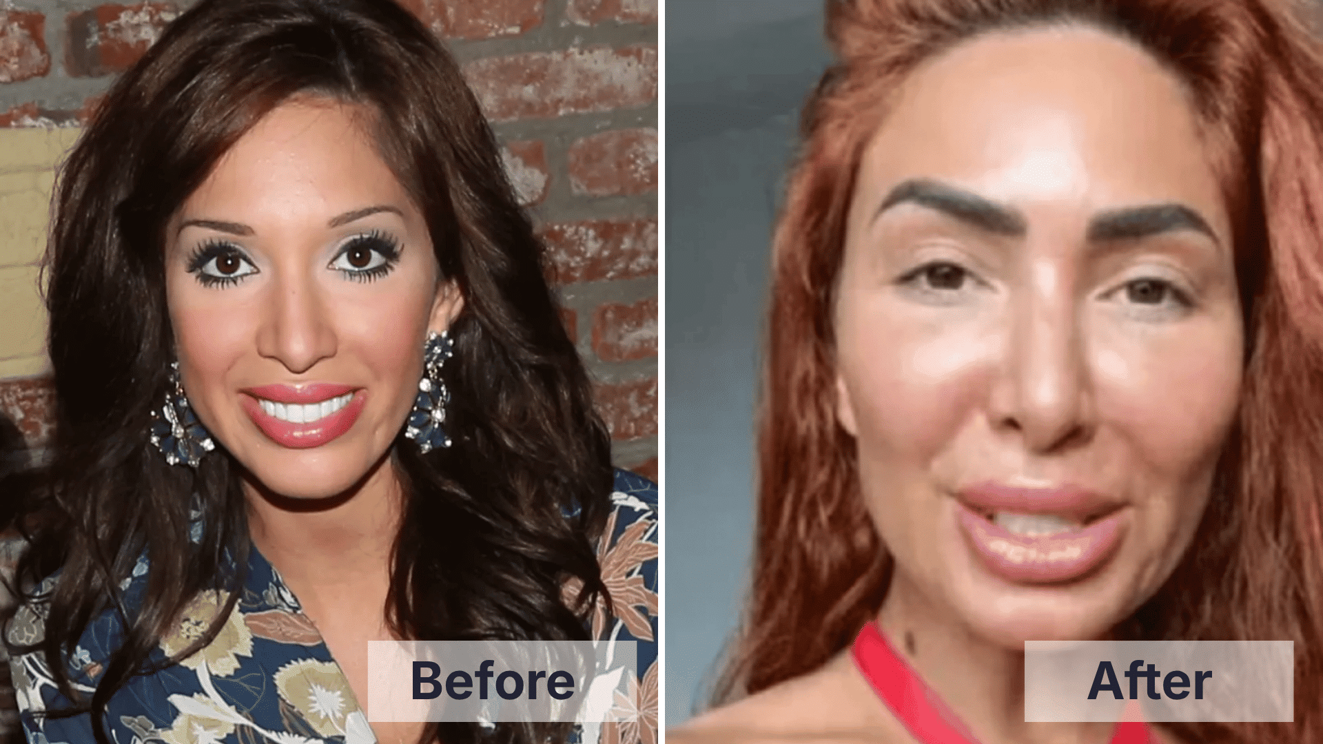 Farrah Abraham before and after facial changes shown in a split image for worst celebrity plastic surgery examples.