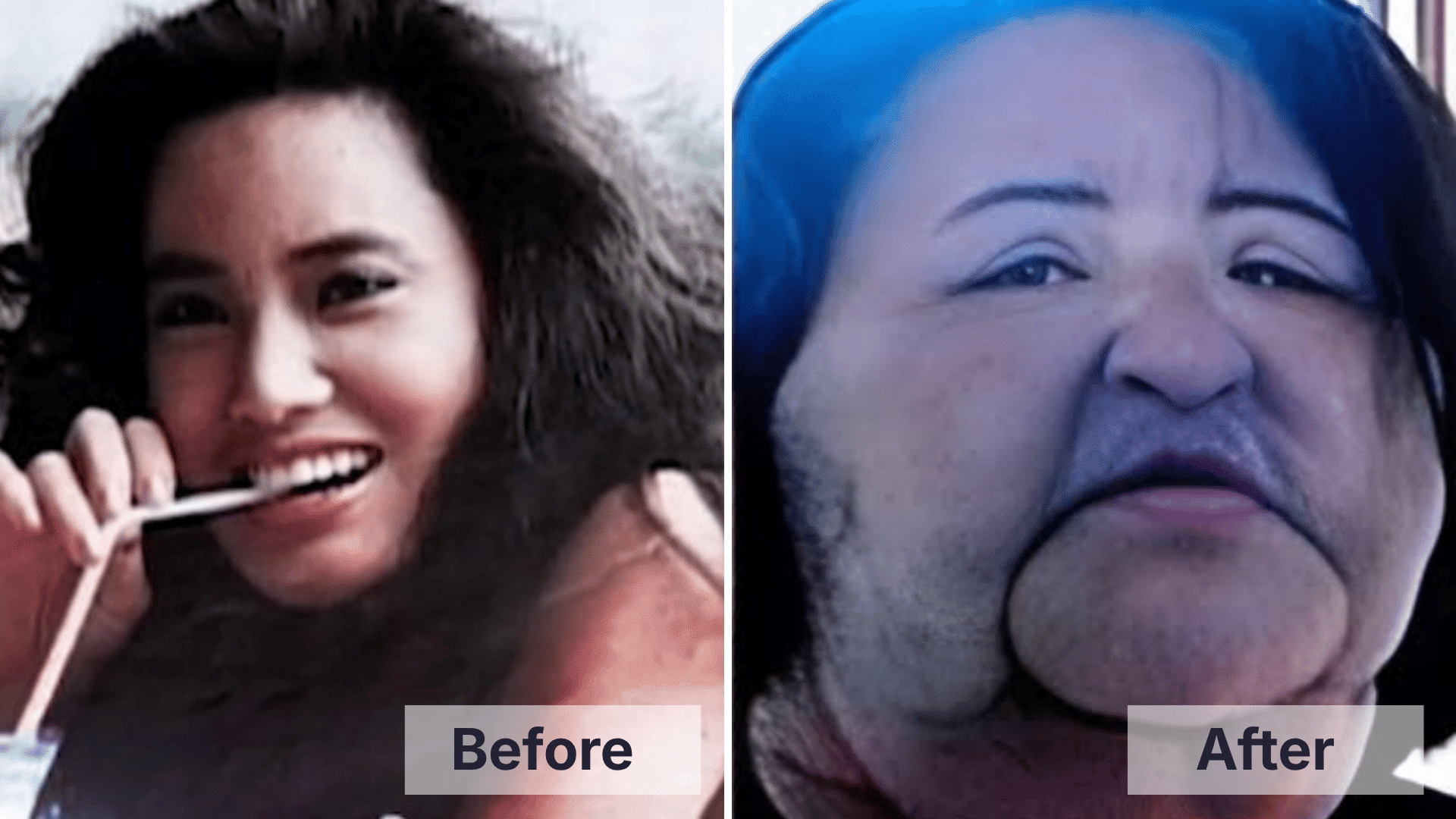Hang Mioku before and after facial changes shown in a split image for worst celebrity plastic surgery examples.