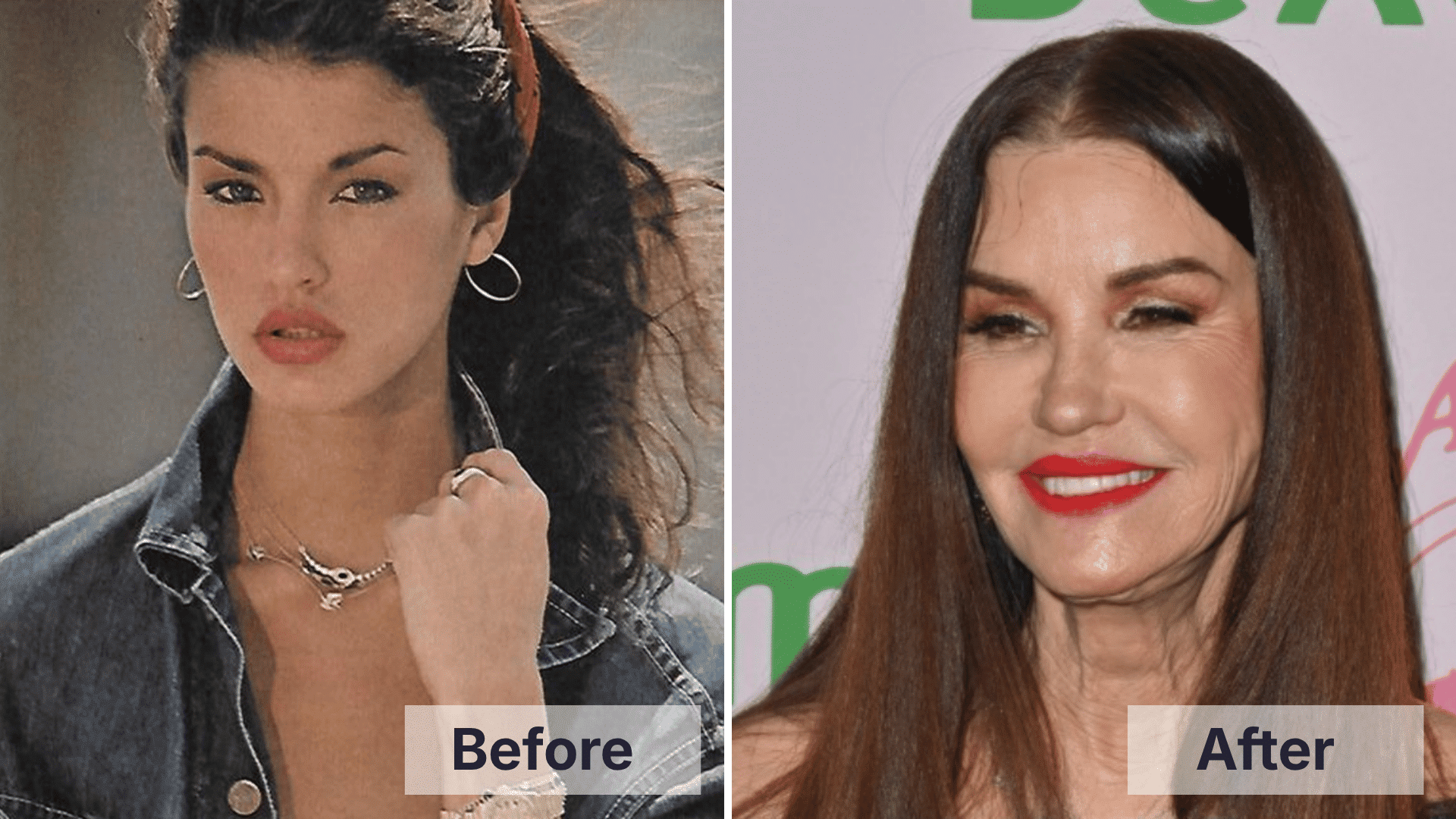 Janice Dickinson appearance changes in worst celebrity plastic surgery discussions