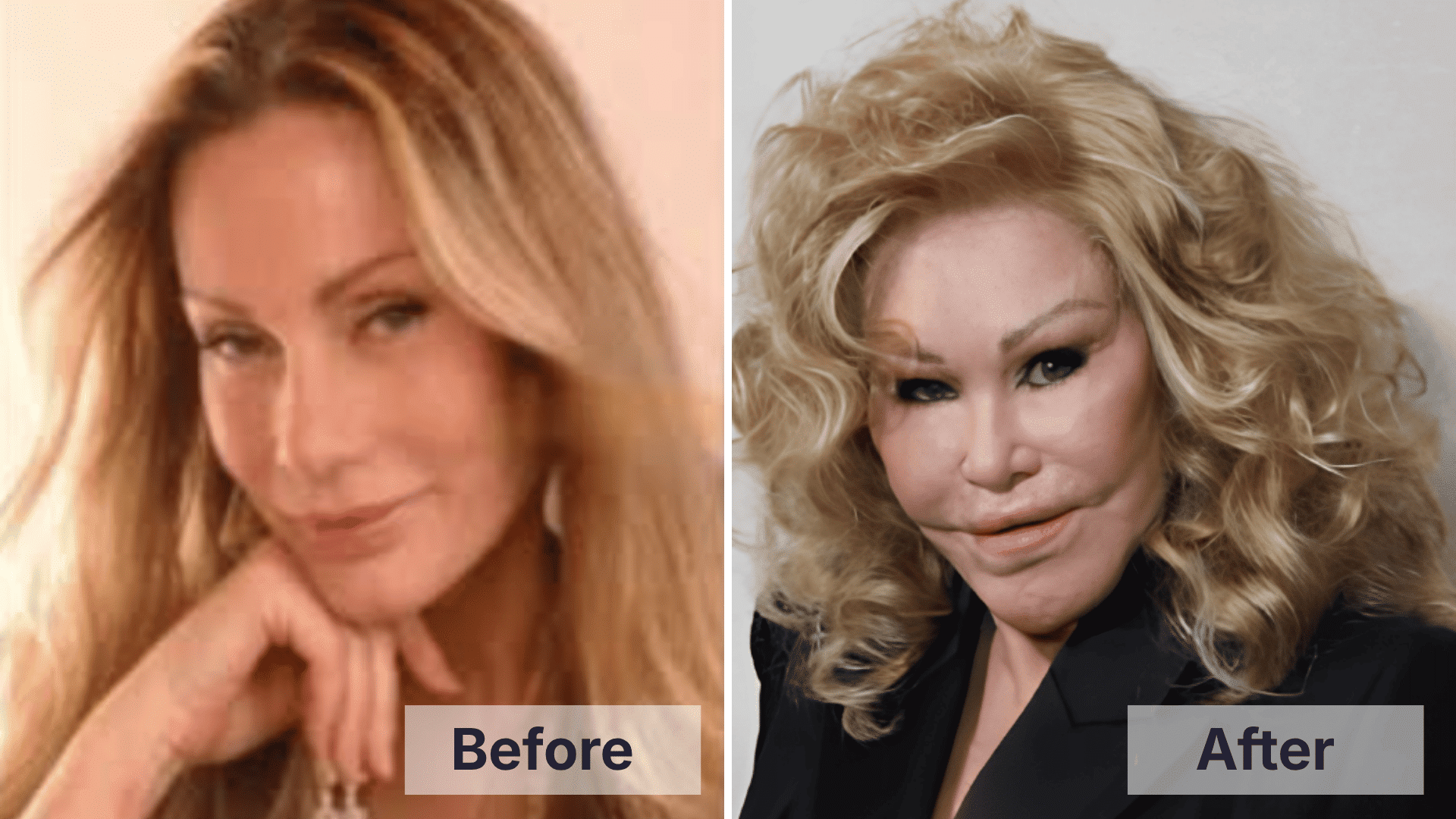 Jocelyn Wildenstein before and after facial changes shown in a split image for worst celebrity plastic surgery examples.
