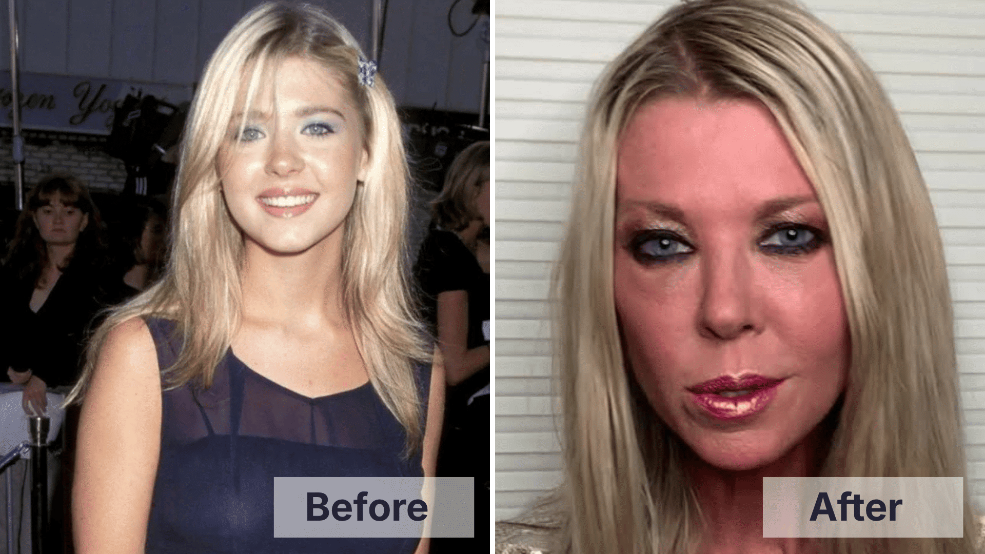 Tara Reid, the American actress, faced intense public criticism after cosmetic surgery