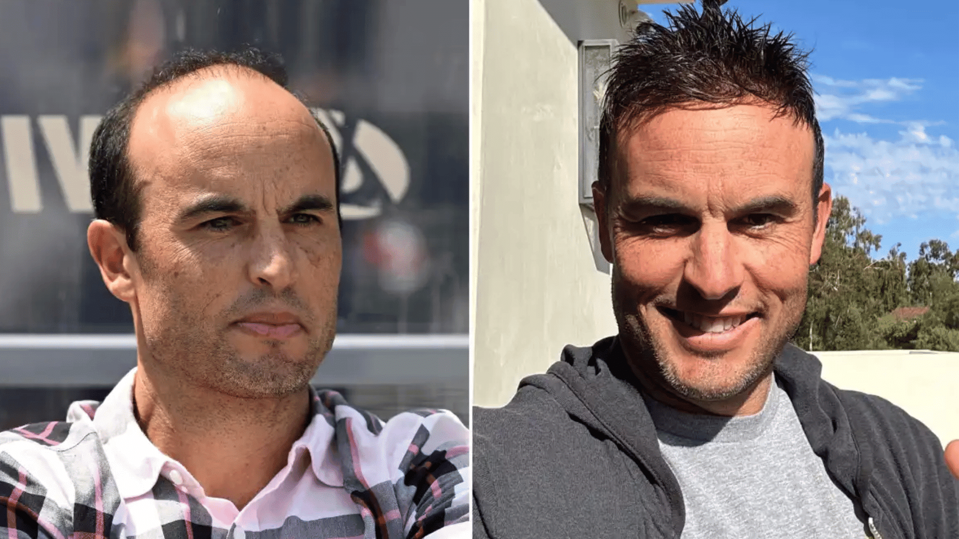Side-by-side images of a man with receding hairline on the left looking serious indoors, and the same man with spiked hair smiling outdoors in sunlight.