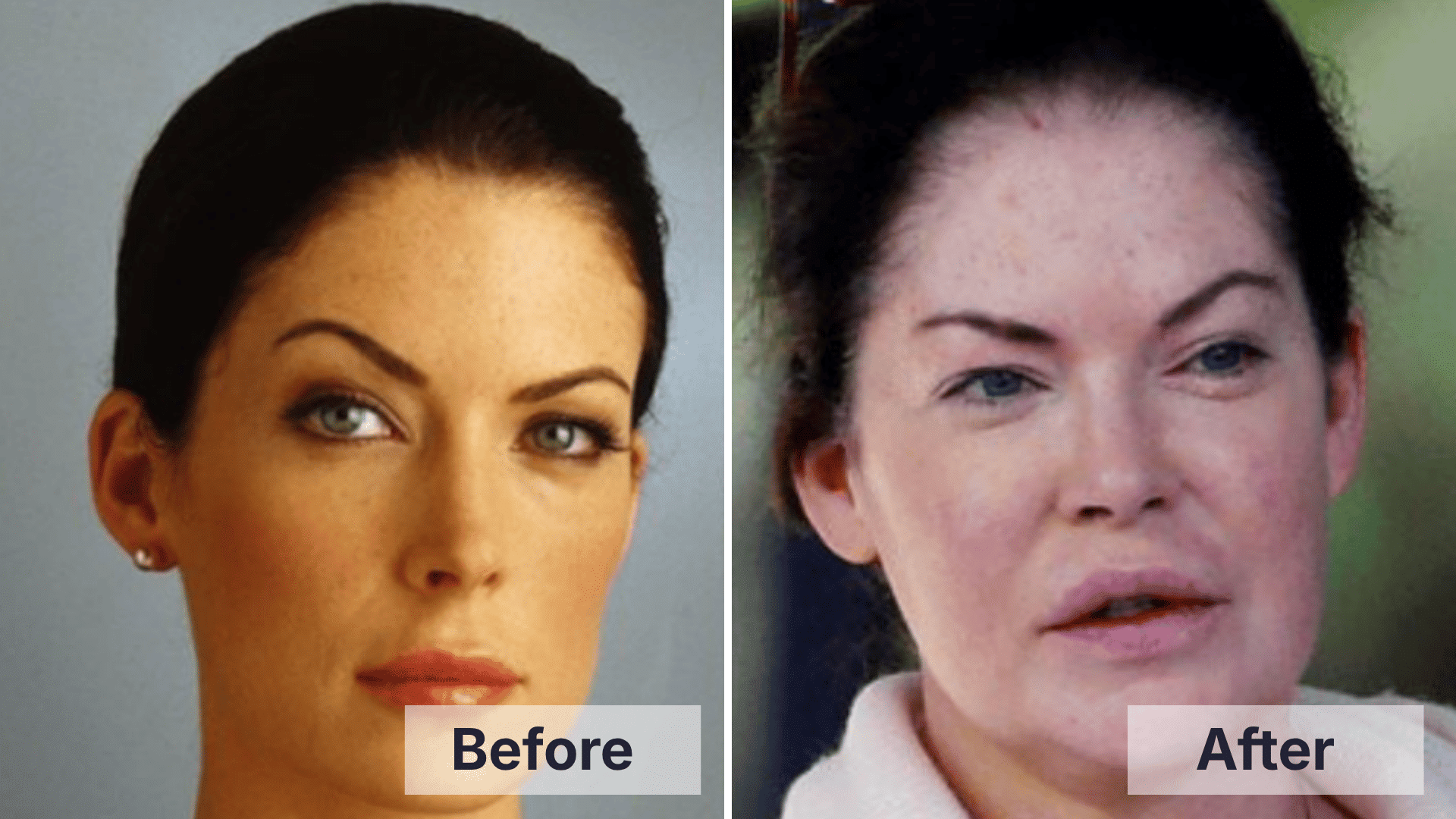 Lara Flynn Boyle before and after facial changes shown in a split image for worst celebrity plastic surgery examples.