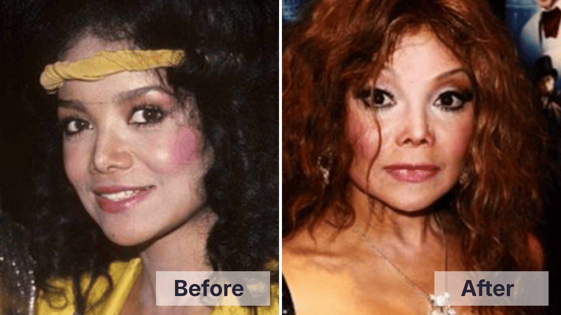 LaToya Jackson before and after comparison showing the changes discussed in the worst celebrity plastic surgery examples.