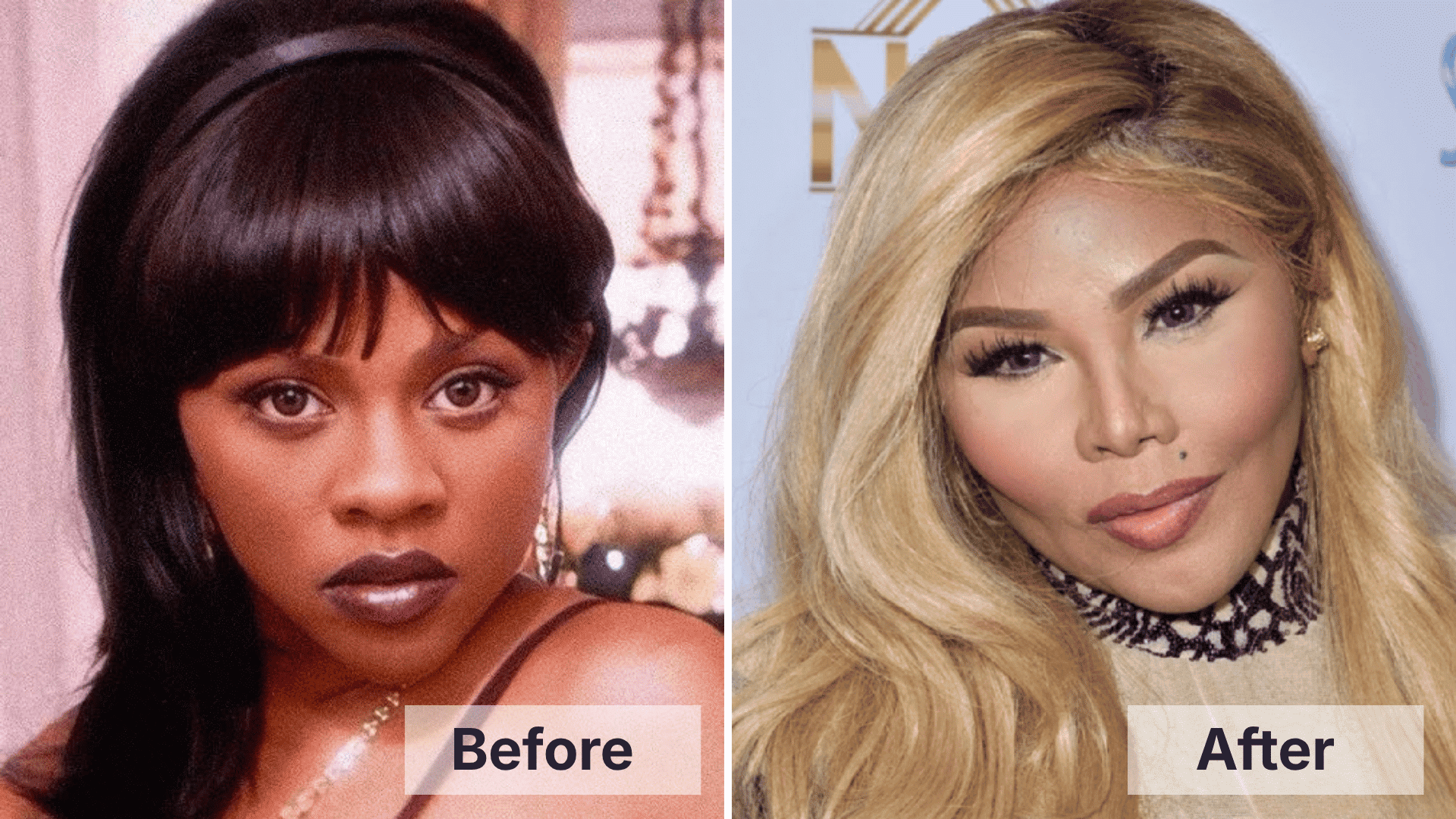 Lil Kim before and after facial changes shown in a split image for worst celebrity plastic surgery examples.