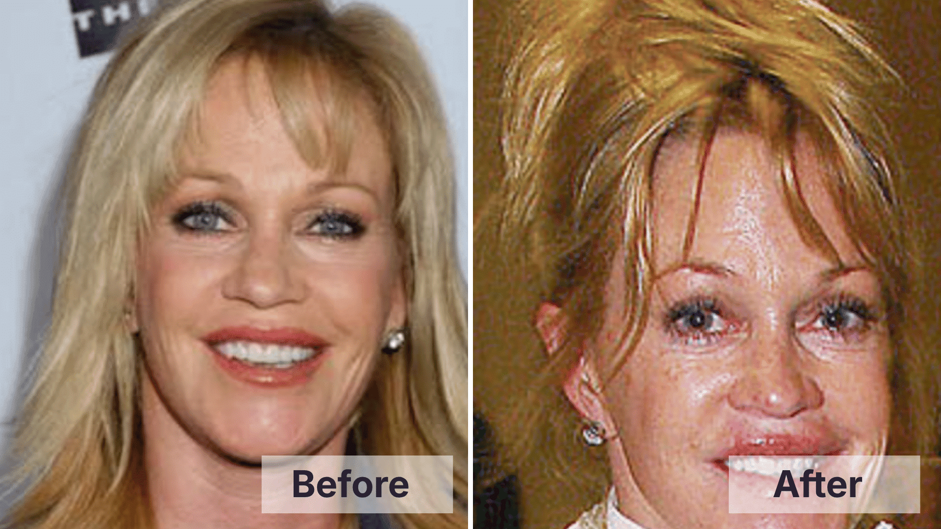 Melanie Griffith before and after facial changes shown in a split image for worst celebrity plastic surgery examples.