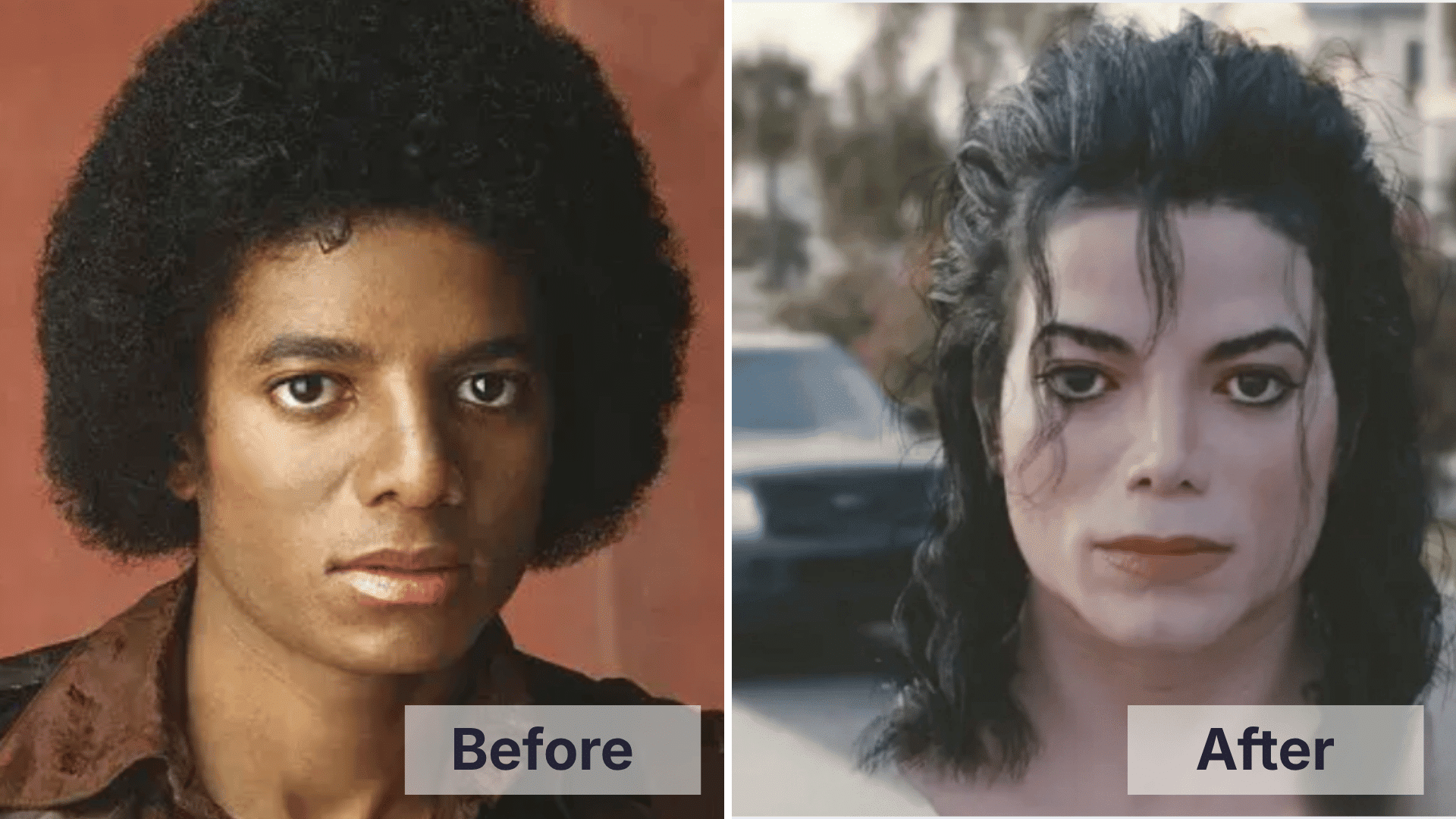 Michael Jackson before and after facial changes shown in a split image for worst celebrity plastic surgery examples.
