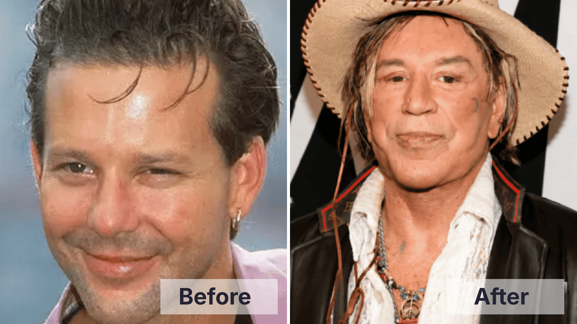 Mickey Rourke before and after facial changes shown in a split image for worst celebrity plastic surgery examples.