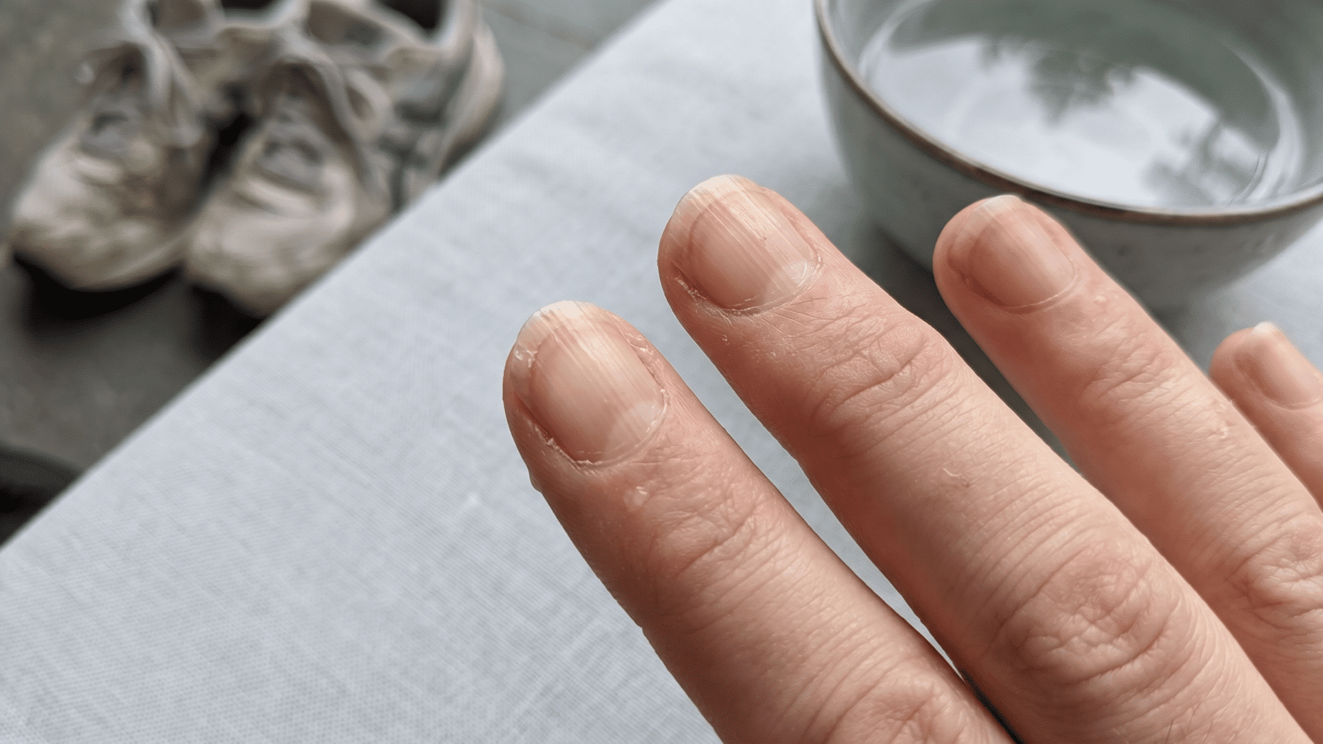 Natural fingernails with mild ridges, splitting, and yellow discoloration from repeated minor nail damage.