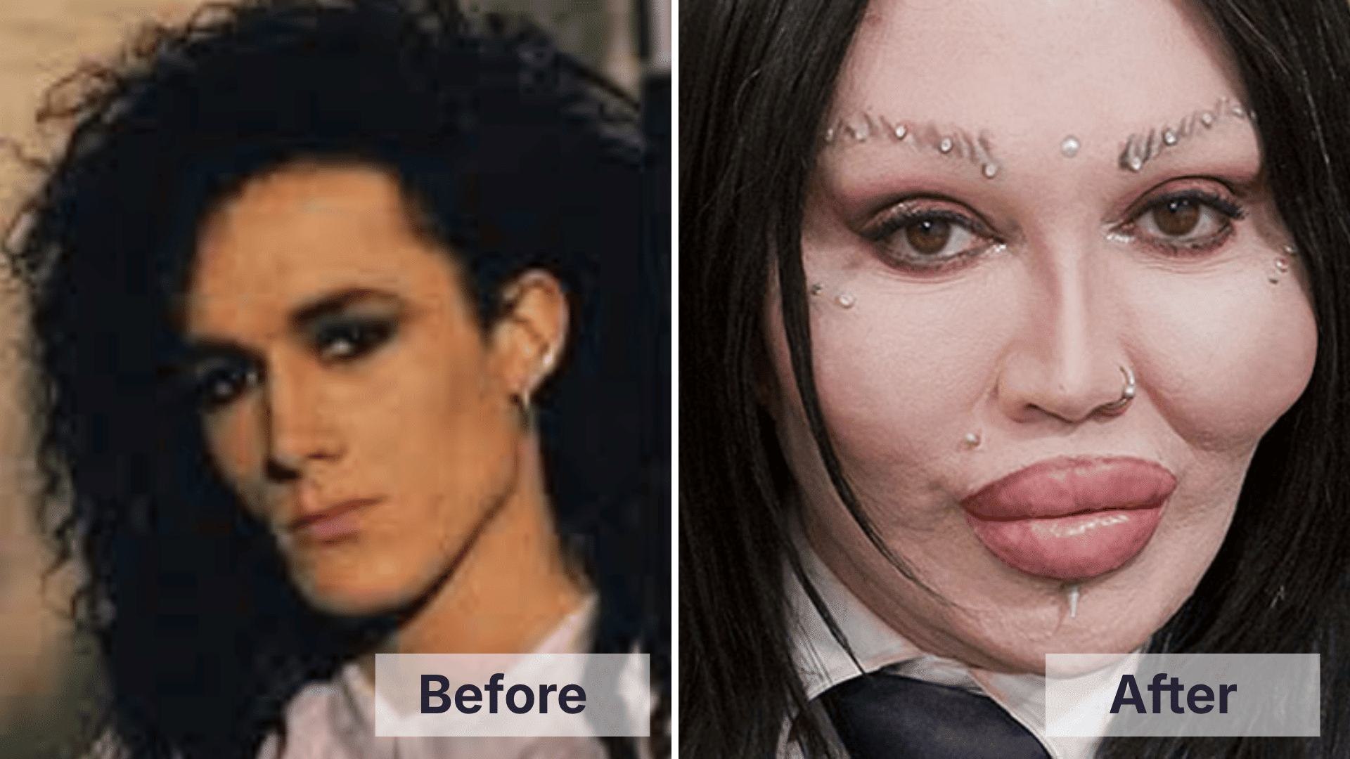 Pete Burns before and after facial changes shown in a split image for worst celebrity plastic surgery examples.