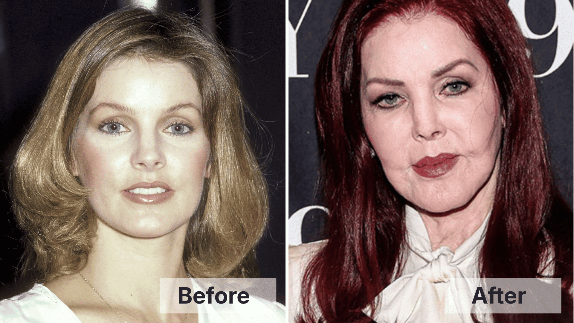 Priscilla Presley before and after facial changes shown in a split image for worst celebrity plastic surgery examples.