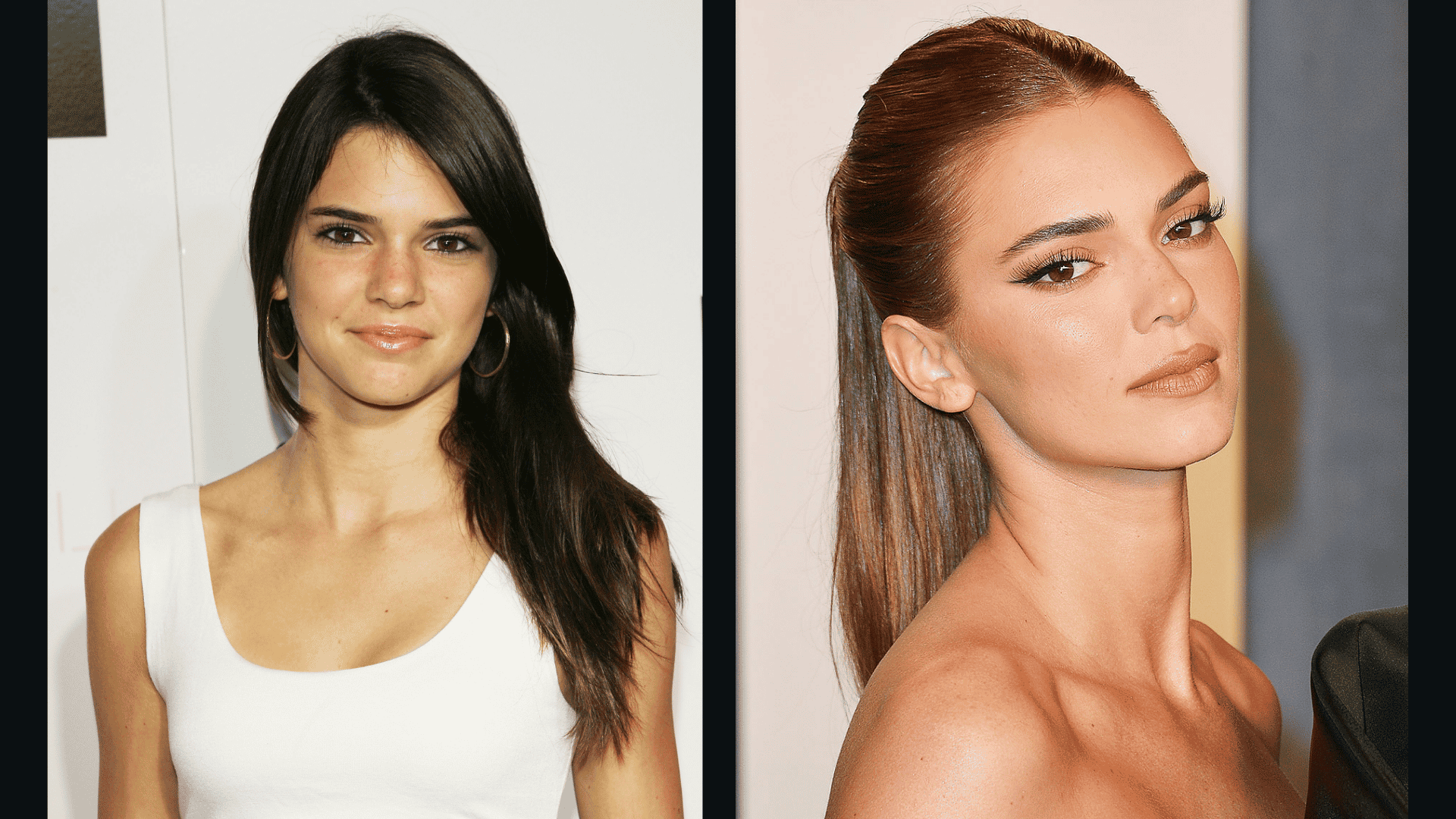 Kendall Jenner before and after portraits showing a celebrity endoscopic brow lift-inspired higher, more defined brow shape.