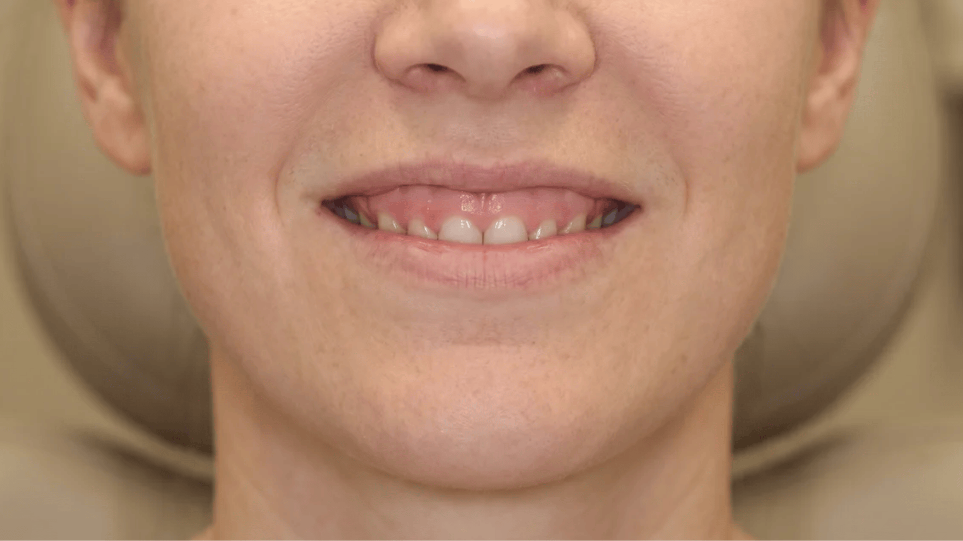 Close-up of a smiling person showing clean, healthy teeth and natural lips in a warm indoor setting.