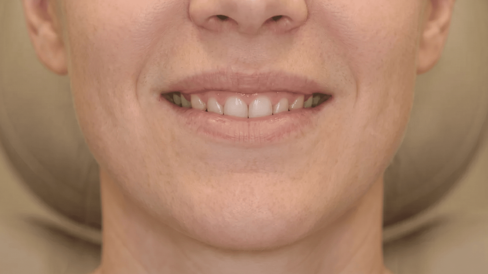 Close-up of a smiling person showing natural upper lip shape and visible teeth against a neutral background.