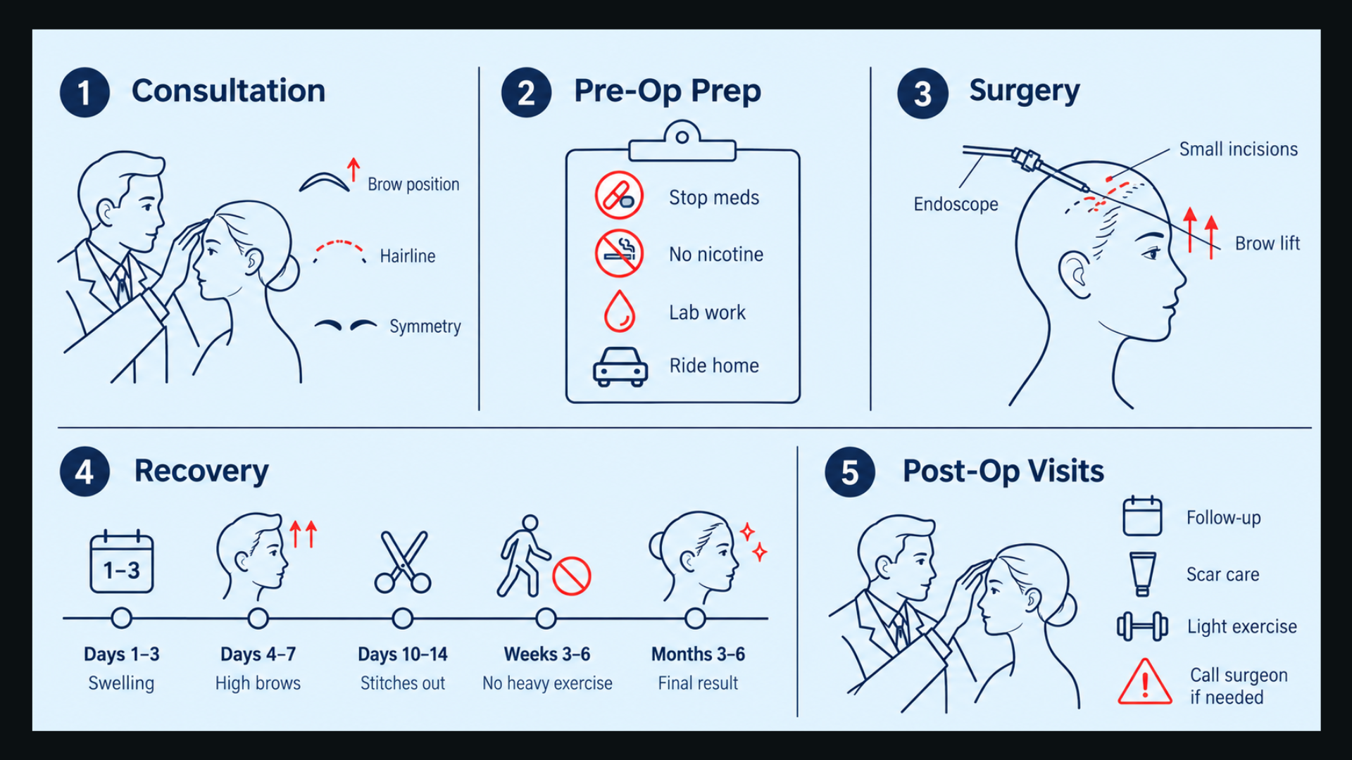 Endoscopic brow lift timeline showing consultation, pre-op prep, surgery, recovery, and post-op follow-up stages.
