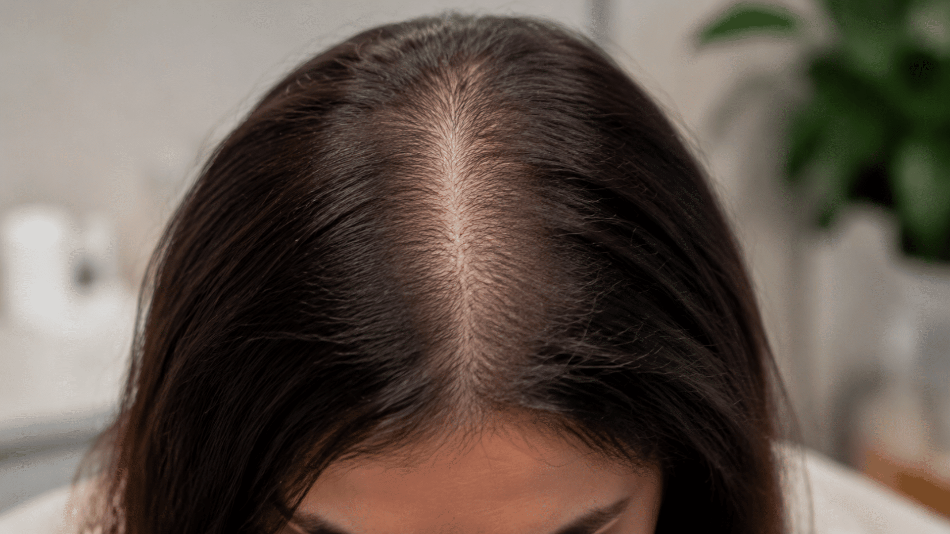 A women hairline and question arising about who Is a Good Candidate for SMP?