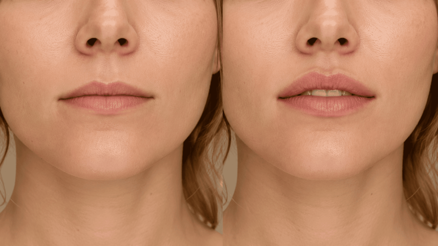 lip-flip-comparison