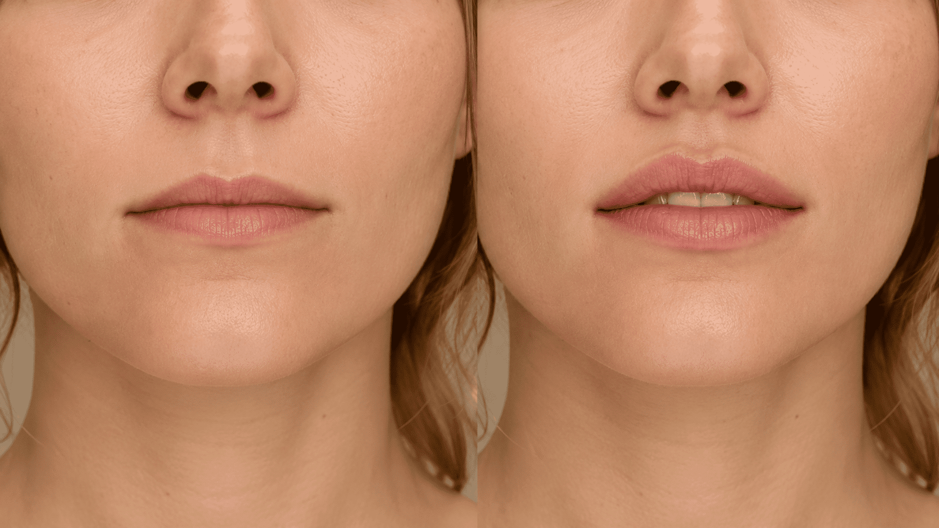 lip-flip-comparison